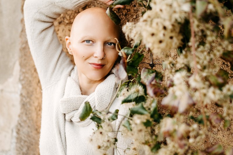 Za alopecijo trpi tudi znana Slovenka, ki je spregovorila o incidentu na oskarjih (foto: Mojfokus Neža Plestenjak)