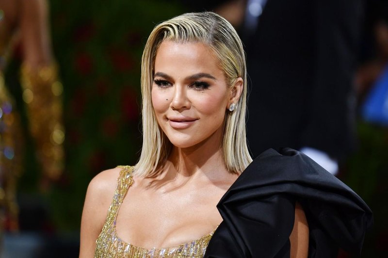 (FOTO): Khloe Kardashian končno priznala, katere lepotne operacije si je omislila (foto: Profimedia)