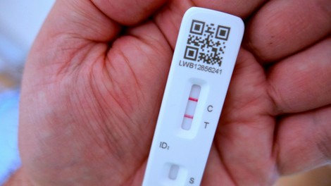 Koronavirus v Sloveniji: to so včerajšnje številke