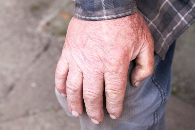 Moški živi v izjemno slabih razmerah, občina Kočevje pa se je zganila šele po objavi v medijih (kje so bili prej?) (foto: Profimedia)