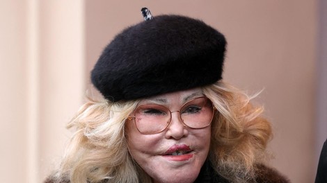 Jocelyn Wildenstein